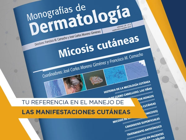 Monografías Dermatología