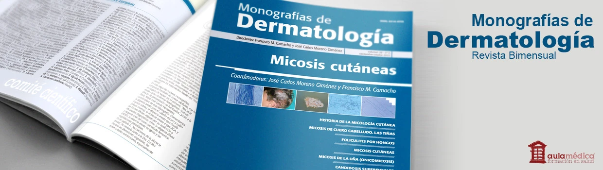 Monografias-de-Dermatologia