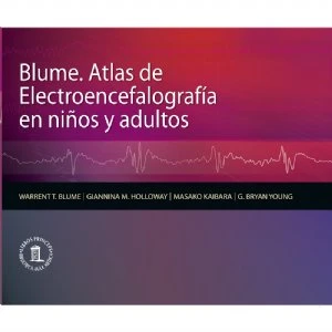 Atlas Electroencefalografía