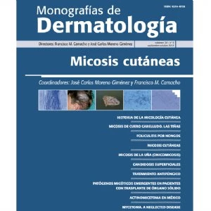 Monografías Dermatología