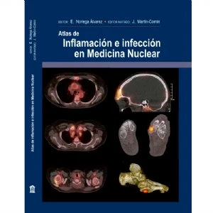 Atlas Inflamación