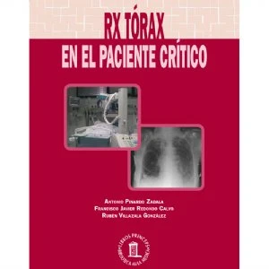 RX Tórax paciente crítico