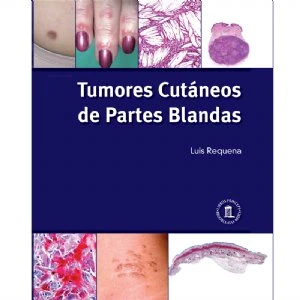 Tumores cutáneos