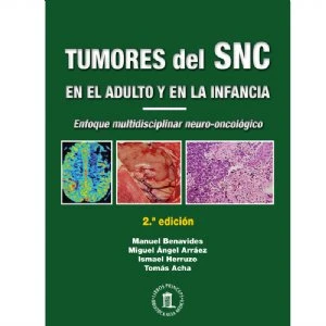 Tumores